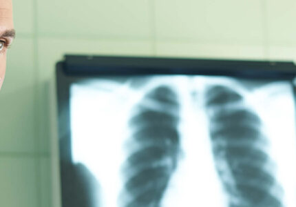 Enfermedades profesionales del sistema respiratorio