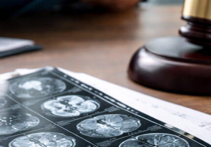 Qué pruebas médicas sirven en un juicio